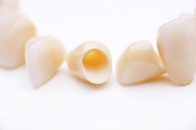 Dental Crowns | McKnight Signature Dental