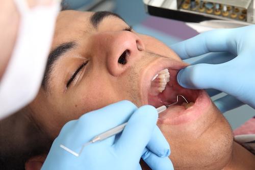 Dental Exam on Man | McKnight Signature Dental